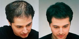 Efecto creación de pelo