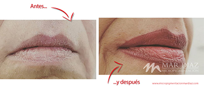 micropigmentación labios antes y después