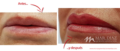 micropigmentación labios antes y después