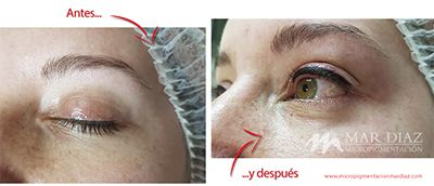 micropigmentación ojos antes y después